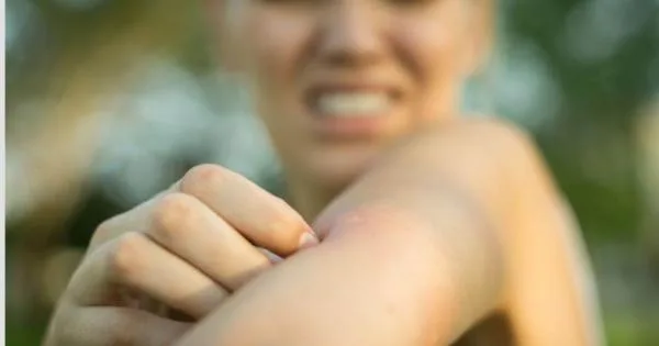 Комарците убиваат најмногу луѓе на светско ниво