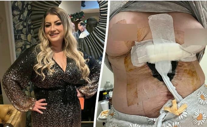  Била на третман во Турција од 14.000 фунти: Ме искасапија, имам дупки на стомакот, немам гради