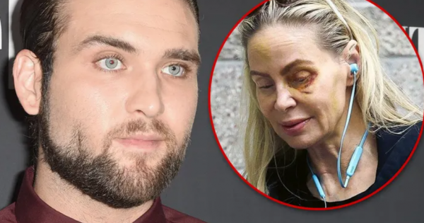  Уапсен синот на Николас Кејџ: Ја нападнал мајката, таа е сликана со модринки на лицето